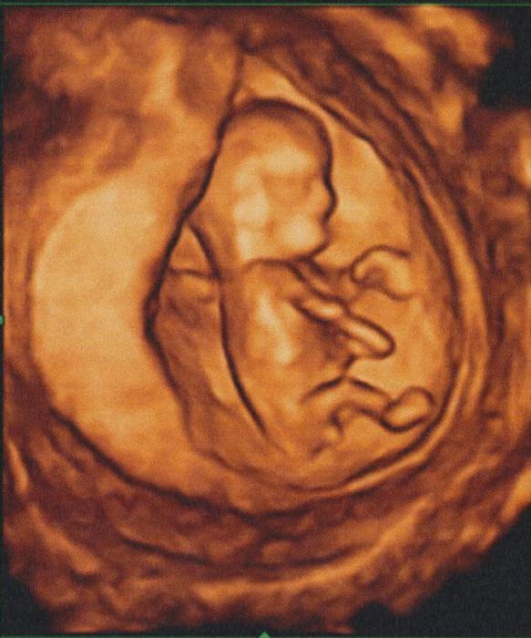 Dimensione del feto di gestazione di 10 settimane