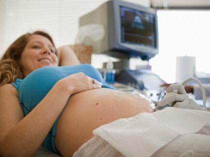 ultrazvok 13 tednov nosečnosti