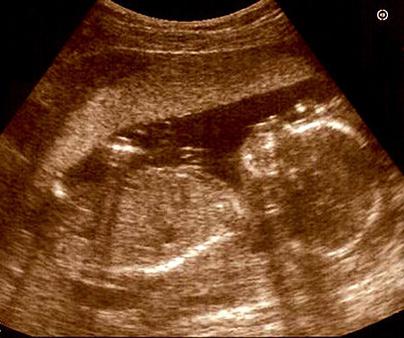 Dimensione del feto di gestazione di 16 settimane