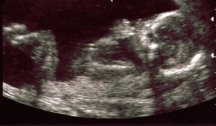 16 седмица от бременността какво се случва