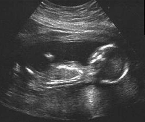 16 tednov noseča otroška fotografija