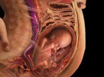 spontani splav pri 23 tednih nosečnosti, kako se to zgodi