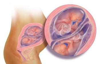 26 týdnů těhotenství dvojčat