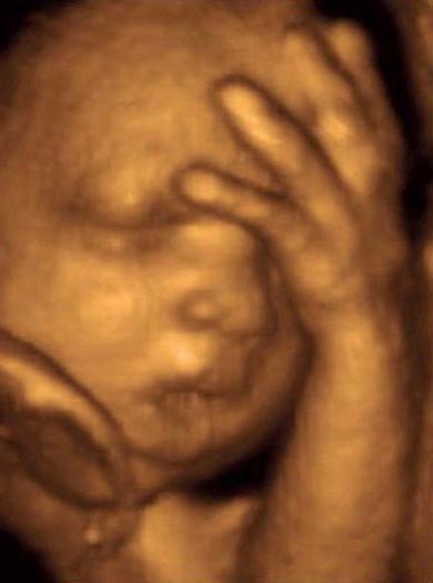 29 týdnů těhotenství fetální fotografie