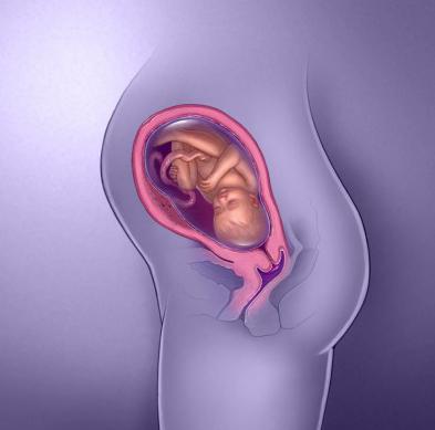 Dimissione di gravidanza di 31 settimane