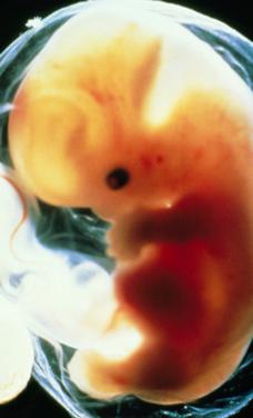 фетус величине 7 недеља