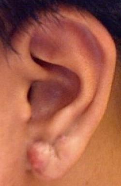 earlobe