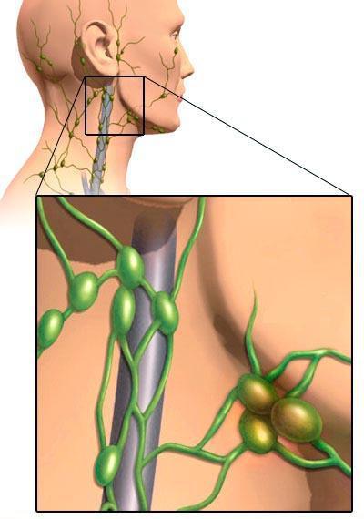 zvětšené lymfatické uzliny v krku
