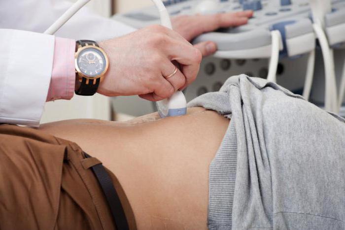 který u dospělých ukáže ultrazvuk břišní dutiny