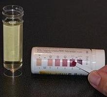 acetona v urinskih vzrokih