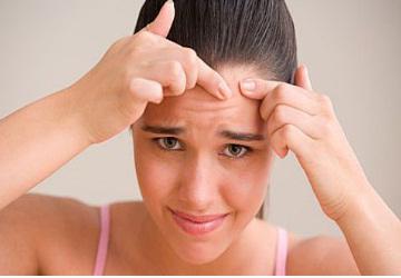 L'acne sulla fronte durante la gravidanza