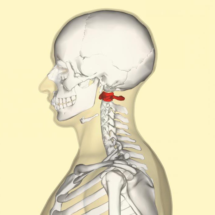 akupunktura dla osteochondrozy przeglądów kręgosłupa szyjnego