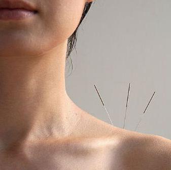 punti di agopuntura sul corpo umano