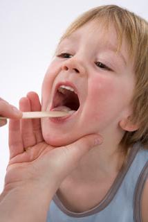 Akutni tonzilitis kod djece