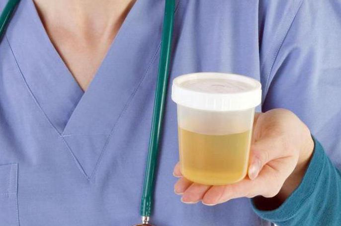 akutno zastajanje urina pri ženskah
