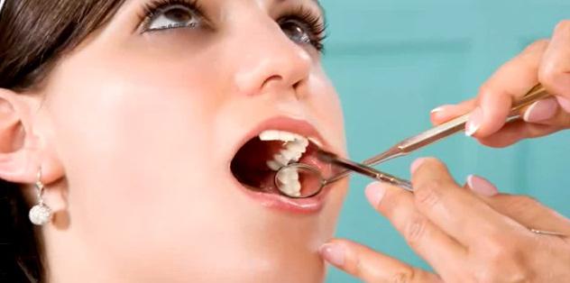 dente dolorante dopo trattamento canalare