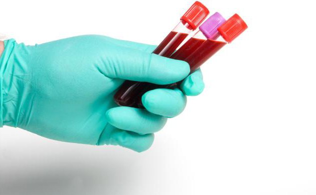 algoritmus odběru vzorků krve
