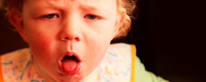 alergijski kašelj pri otrocih