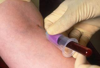 rw krevní test