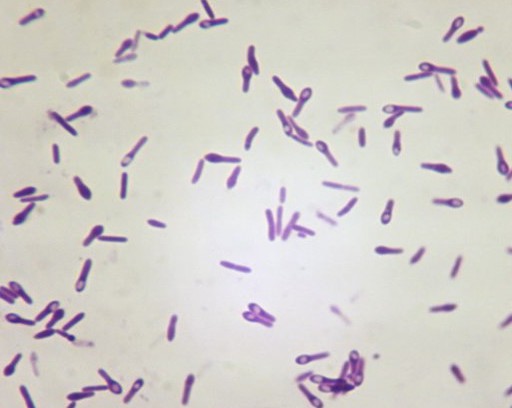 Clostridium buňky s endosporami