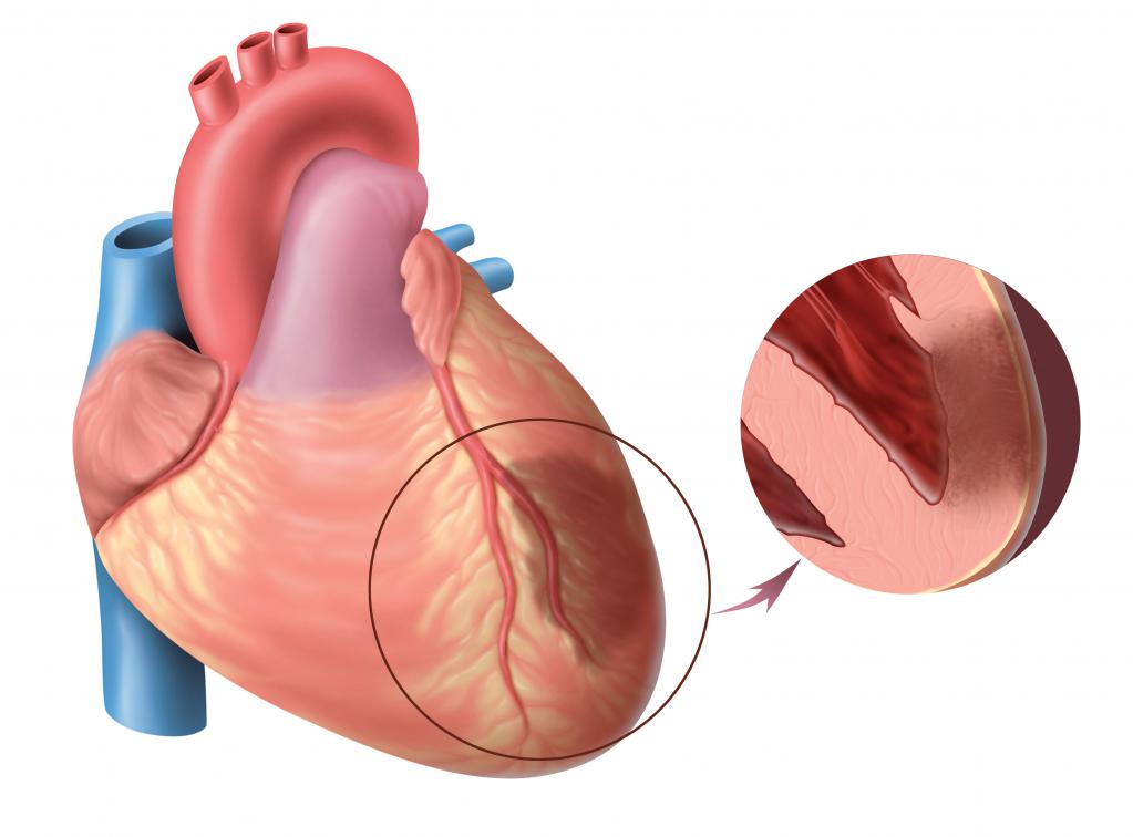 analoghi per applicazioni cardiache
