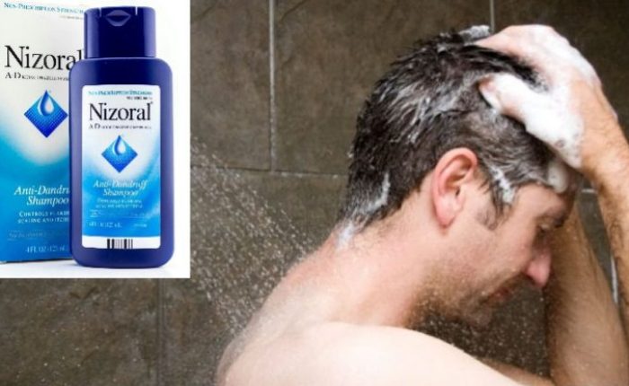 nizoralni analogi šampona