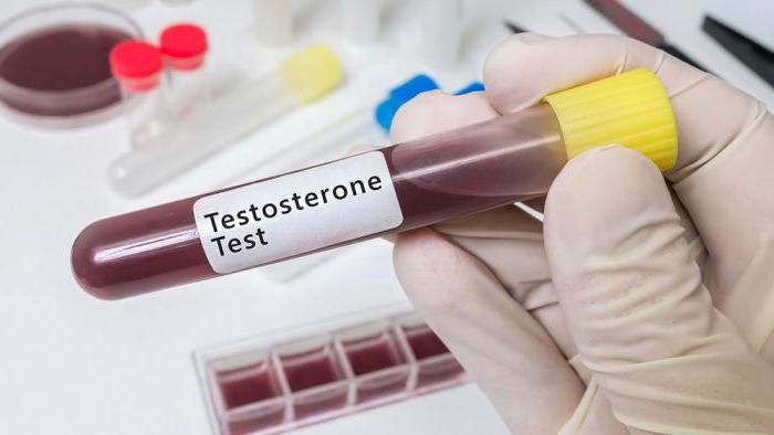 testiranje testosterona za moške