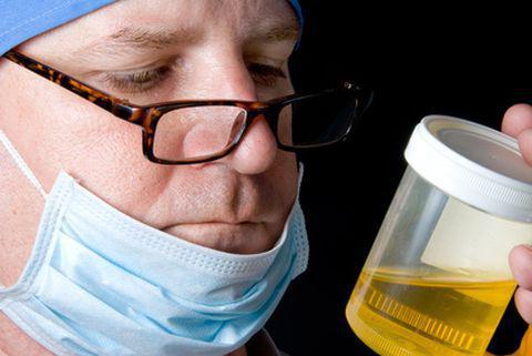 transkripti analize urina kod djece