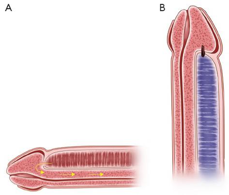 особености на структурата на пениса