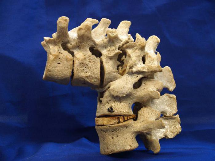 vertebre cervicali di un neonato