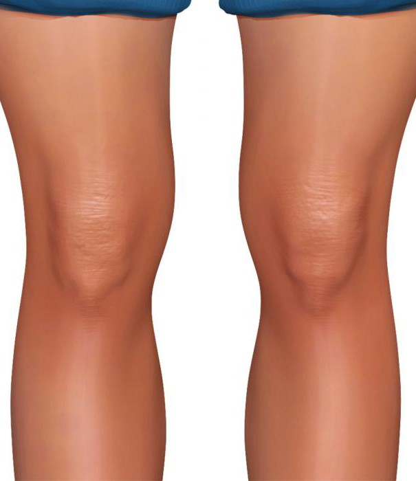 foto di anatomia articolare del ginocchio