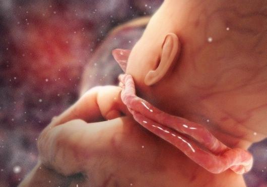 Intrauterina smrt fetusa