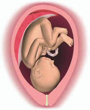 Cause di morte fetale prenatale