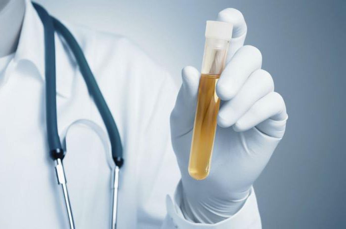 transkript urina za občutljivost na antibiotike