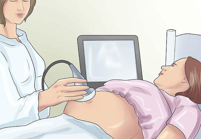 apendicitida během těhotenství, příznaky