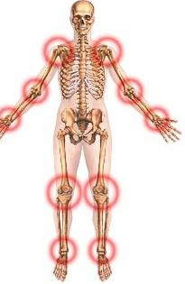 příznaky artritidy