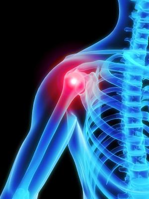 artroza liječenja gimnastike ramenog zgloba