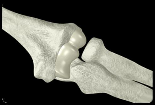 kompleksni pregledi arthrona