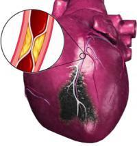aspiryna cardio instrukcje użytkowania