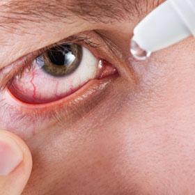 częściowa atrofia nerwu wzrokowego