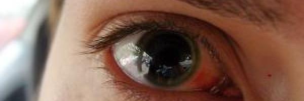 Atropin sulfátové oční kapky