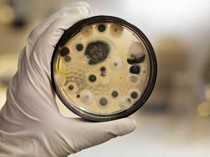 batteri nelle urine