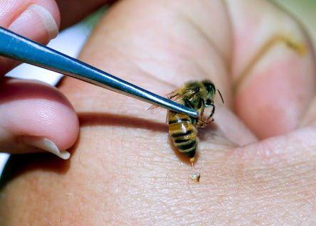 čiščenje čebel