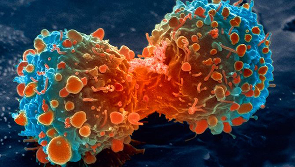 Rakovinové buňky