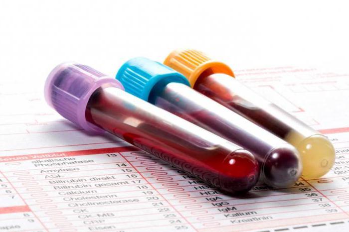 srb in analisi del sangue biochimico