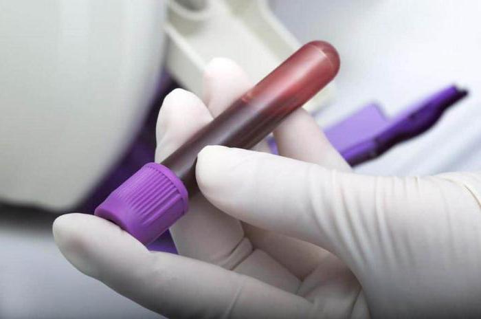 krvni test srb norm pri ženskah