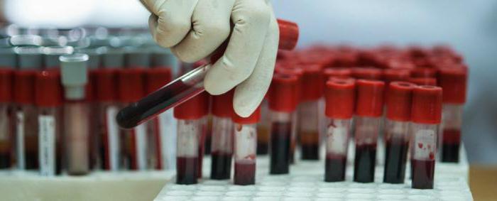 биохемијски тест крви који ће се показати