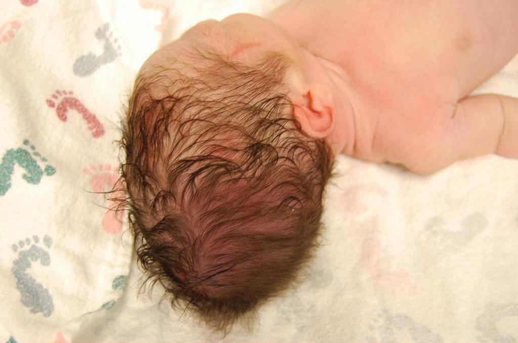 Tvar hlavy novorozence po normálním porodu
