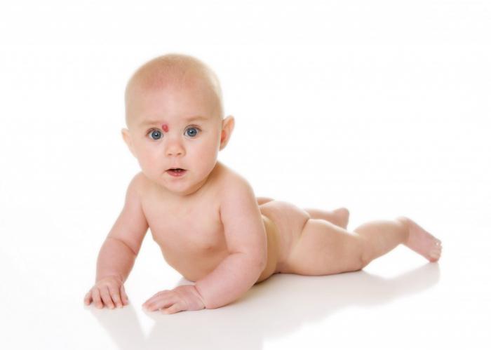 rojstne oznake pri novorojenčkih