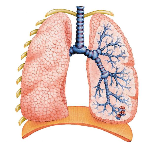 oscuramento nei polmoni